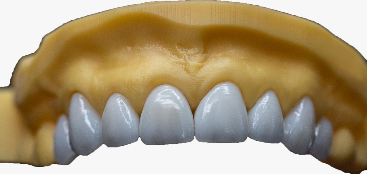 E.Z layered Zirconia