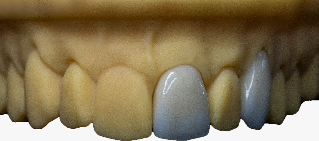 3D Multilithic Zirconia