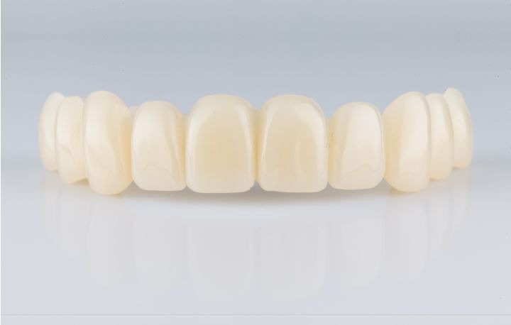 SoReal CAD-CAM Temporaries