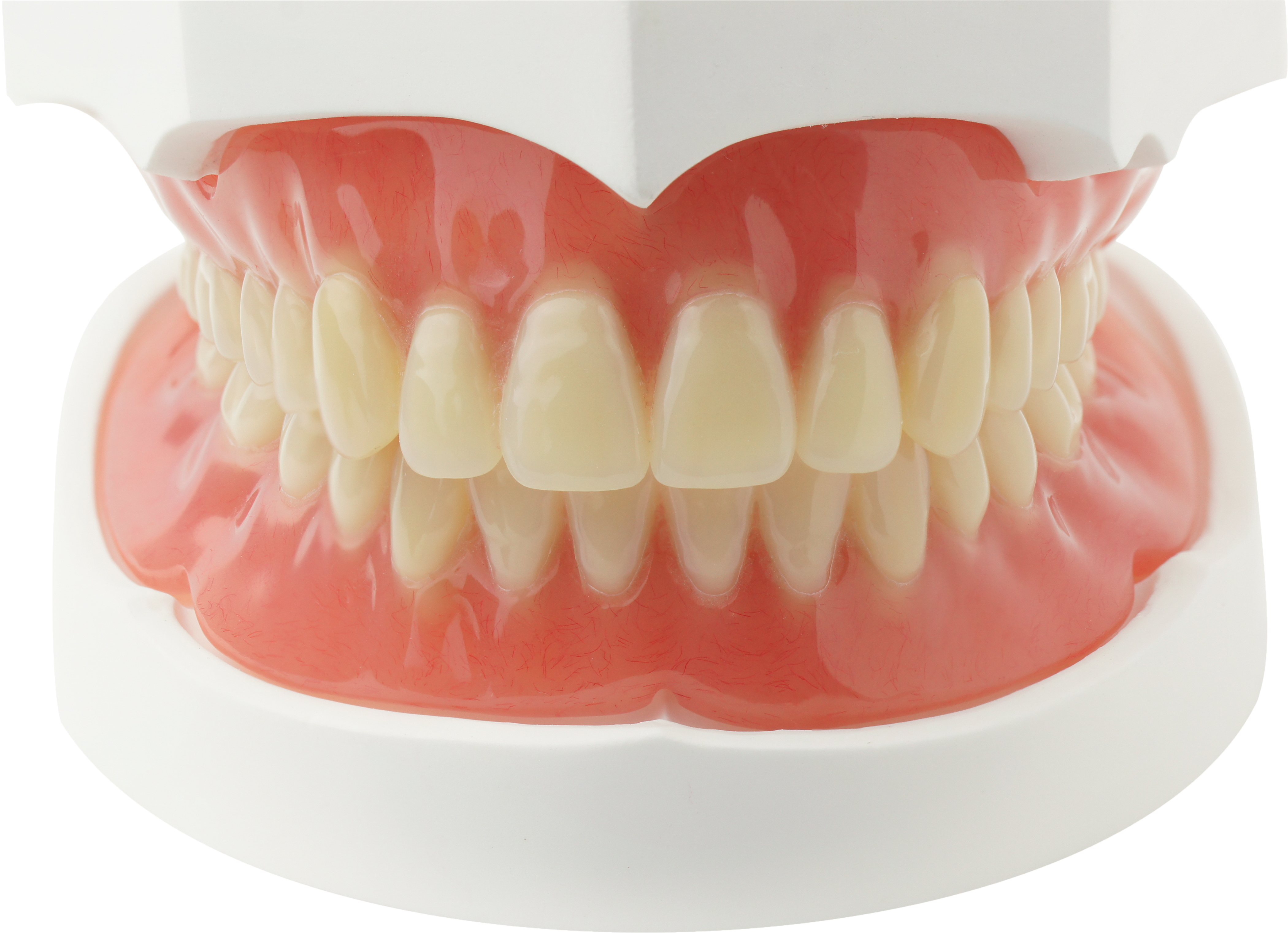 Complete Dentures