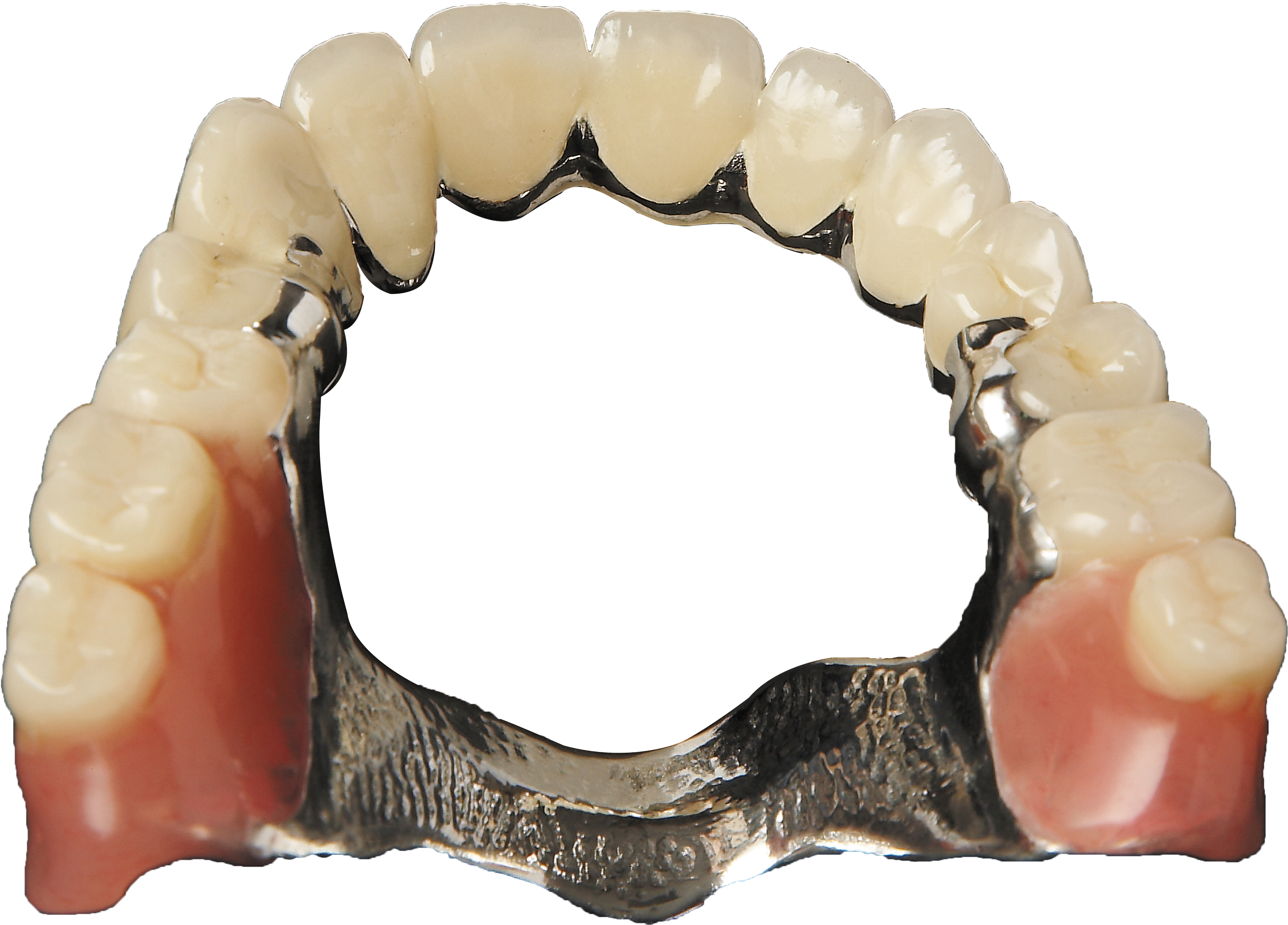Combination Crowns & Partials